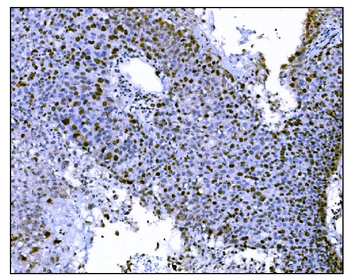 Ki67 Mouse Monoclonal Antibody
