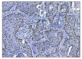 Ki67 Mouse Monoclonal Antibody