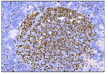 Ki67 Mouse Monoclonal Antibody