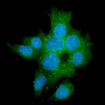 TGFBR2 Mouse Monoclonal Antibody