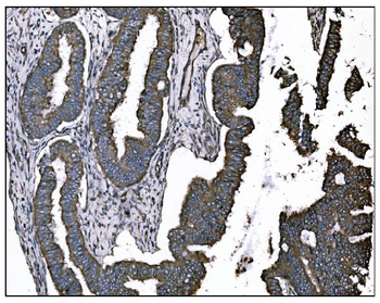 TGFBR2 Mouse Monoclonal Antibody