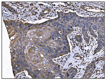 TGFBR2 Mouse Monoclonal Antibody