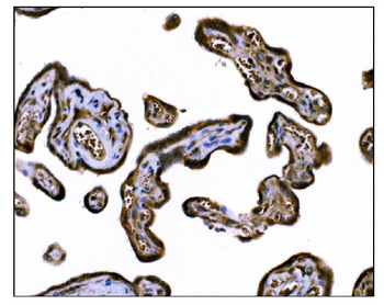 TGFBR2 Mouse Monoclonal Antibody