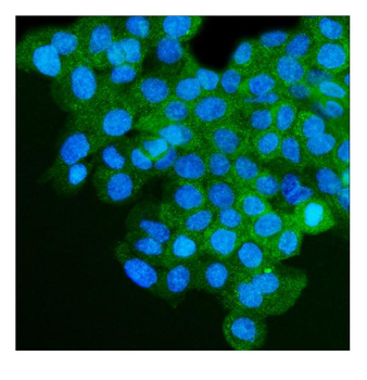 IGF2R Mouse Monoclonal Antibody