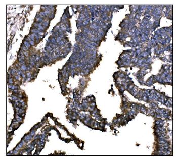 IGF2R Mouse Monoclonal Antibody