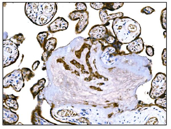 IGF2R Mouse Monoclonal Antibody
