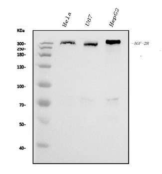 IGF2R Mouse Monoclonal Antibody