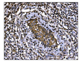 IGF2R Mouse Monoclonal Antibody