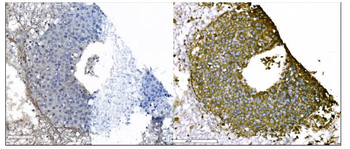 IGF2R Mouse Monoclonal Antibody