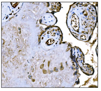 IGF2R Mouse Monoclonal Antibody