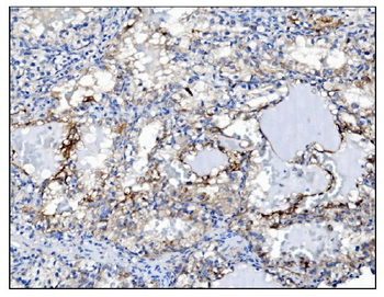 PGP9.5/PGP9 Mouse Monoclonal Antibody