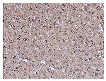 PGP9.5/PGP9 Mouse Monoclonal Antibody