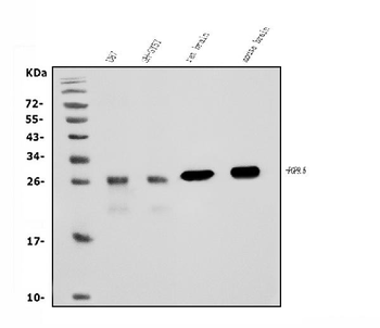 PGP9.5/PGP9 Mouse Monoclonal Antibody