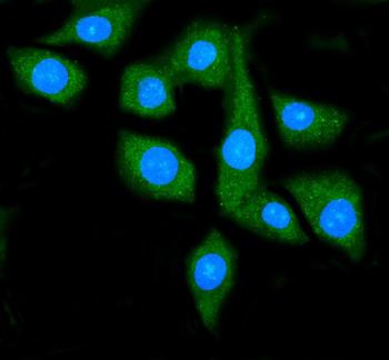 Hsp90 alpha Mouse Monoclonal Antibody