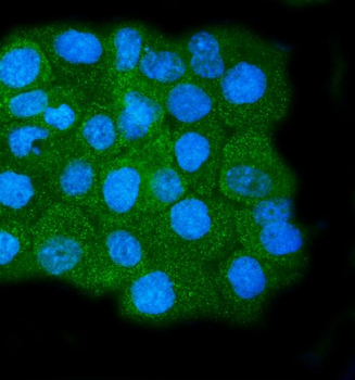 Calpain 1 Mouse Monoclonal Antibody