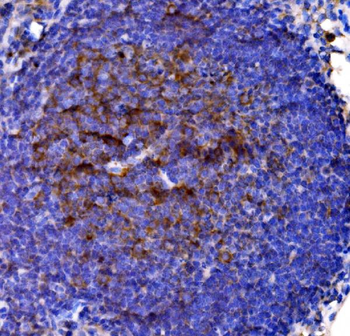 Cd38 Rabbit Polyclonal Antibody