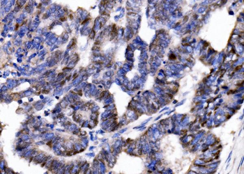 p57 Kip2/CDKN1C Rabbit Polyclonal Antibody