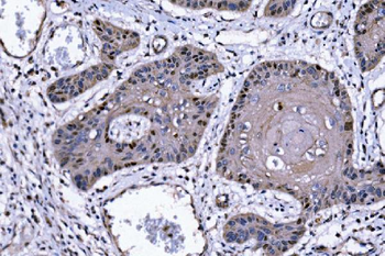 p57 Kip2/CDKN1C Rabbit Polyclonal Antibody