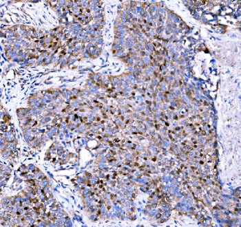 p57 Kip2/CDKN1C Rabbit Polyclonal Antibody