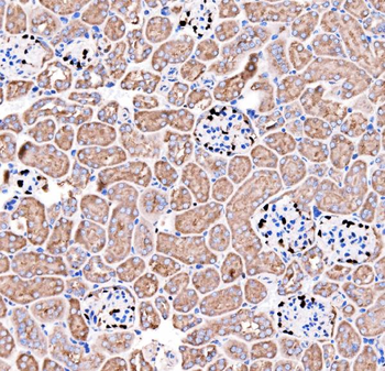 p57 Kip2/CDKN1C Rabbit Polyclonal Antibody