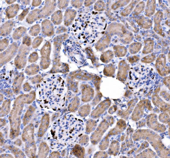 p57 Kip2/CDKN1C Rabbit Polyclonal Antibody