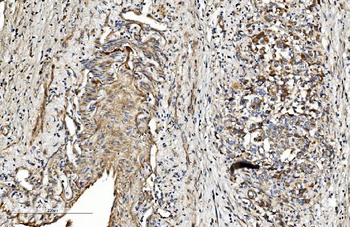 COL4A3 Rabbit Polyclonal Antibody