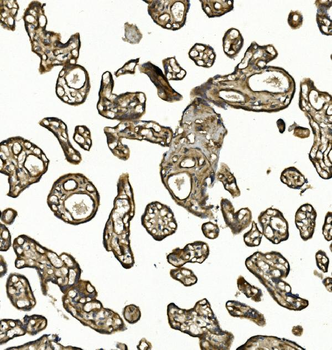 COL4A3 Rabbit Polyclonal Antibody