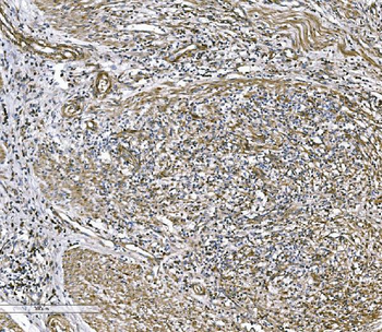 COL4A3 Rabbit Polyclonal Antibody
