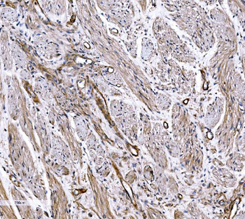 COL4A3 Rabbit Polyclonal Antibody