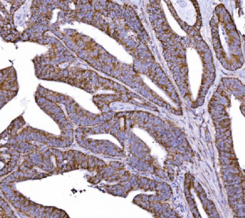 COX6B1 Rabbit Polyclonal Antibody