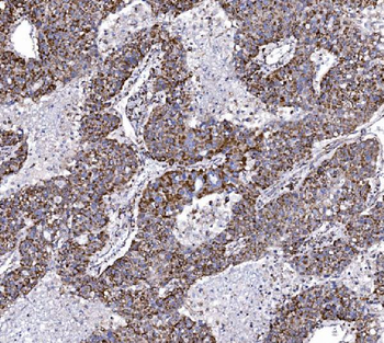 COX6B1 Rabbit Polyclonal Antibody