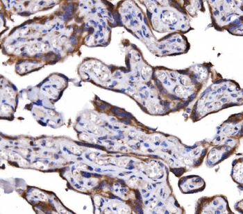 COX6B1 Rabbit Polyclonal Antibody