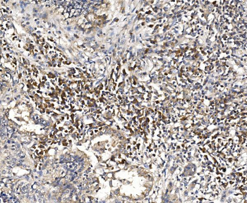 DAP1/DAP Rabbit Polyclonal Antibody