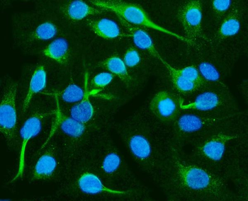 CRMP2/DPYSL2 Rabbit Polyclonal Antibody