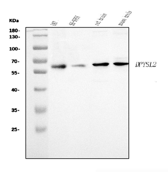 CRMP2/DPYSL2 Rabbit Polyclonal Antibody