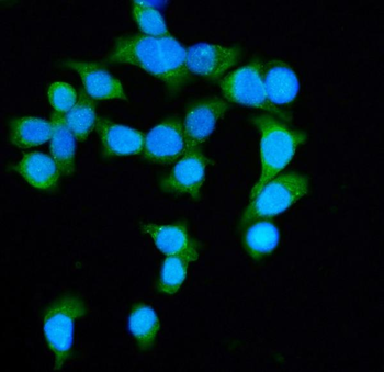 DIAPH1 Rabbit Polyclonal Antibody