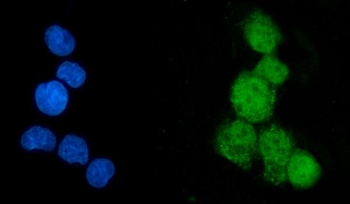 EEF2K Rabbit Polyclonal Antibody
