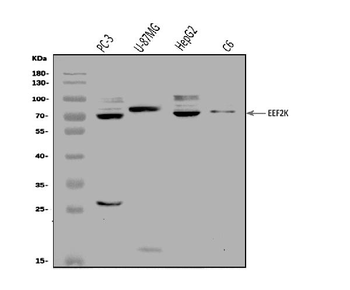 EEF2K Rabbit Polyclonal Antibody