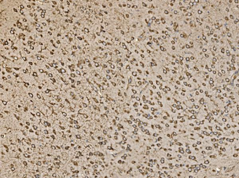 EIF5 Rabbit Polyclonal Antibody
