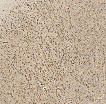 EIF5 Rabbit Polyclonal Antibody