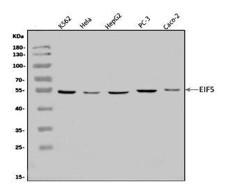 EIF5 Rabbit Polyclonal Antibody