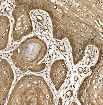 EIF5 Rabbit Polyclonal Antibody