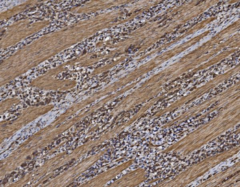 EIF5 Rabbit Polyclonal Antibody