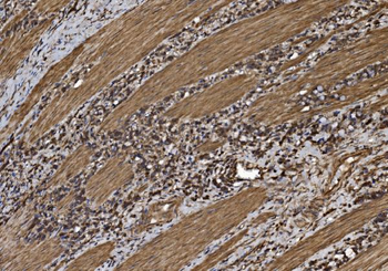 EIF5 Rabbit Polyclonal Antibody