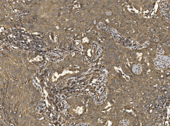 EIF5 Rabbit Polyclonal Antibody