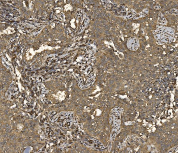 EIF5 Rabbit Polyclonal Antibody