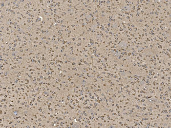 EIF5 Rabbit Polyclonal Antibody