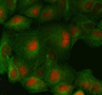 FAF1 Rabbit Polyclonal Antibody
