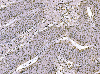 c-Jun/JUN Rabbit Polyclonal Antibody