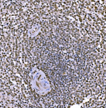 c-Jun/JUN Rabbit Polyclonal Antibody